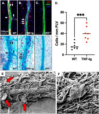 Distinct mast cell subpopulations within and around lymphatic vessels regulate lymph flow and progression of inflammatory-erosive arthritis in TNF-transgenic mice